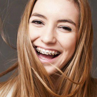 Ortodoncia en adolescentes